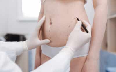 Mommy Makeover 101: A Comprehensive Guide to Post-Pregnancy Transformation