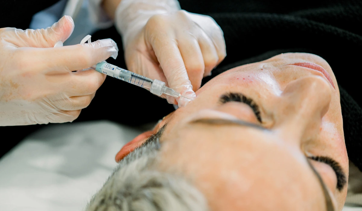 A woman undergoing a facial treatment involving dermal fillers