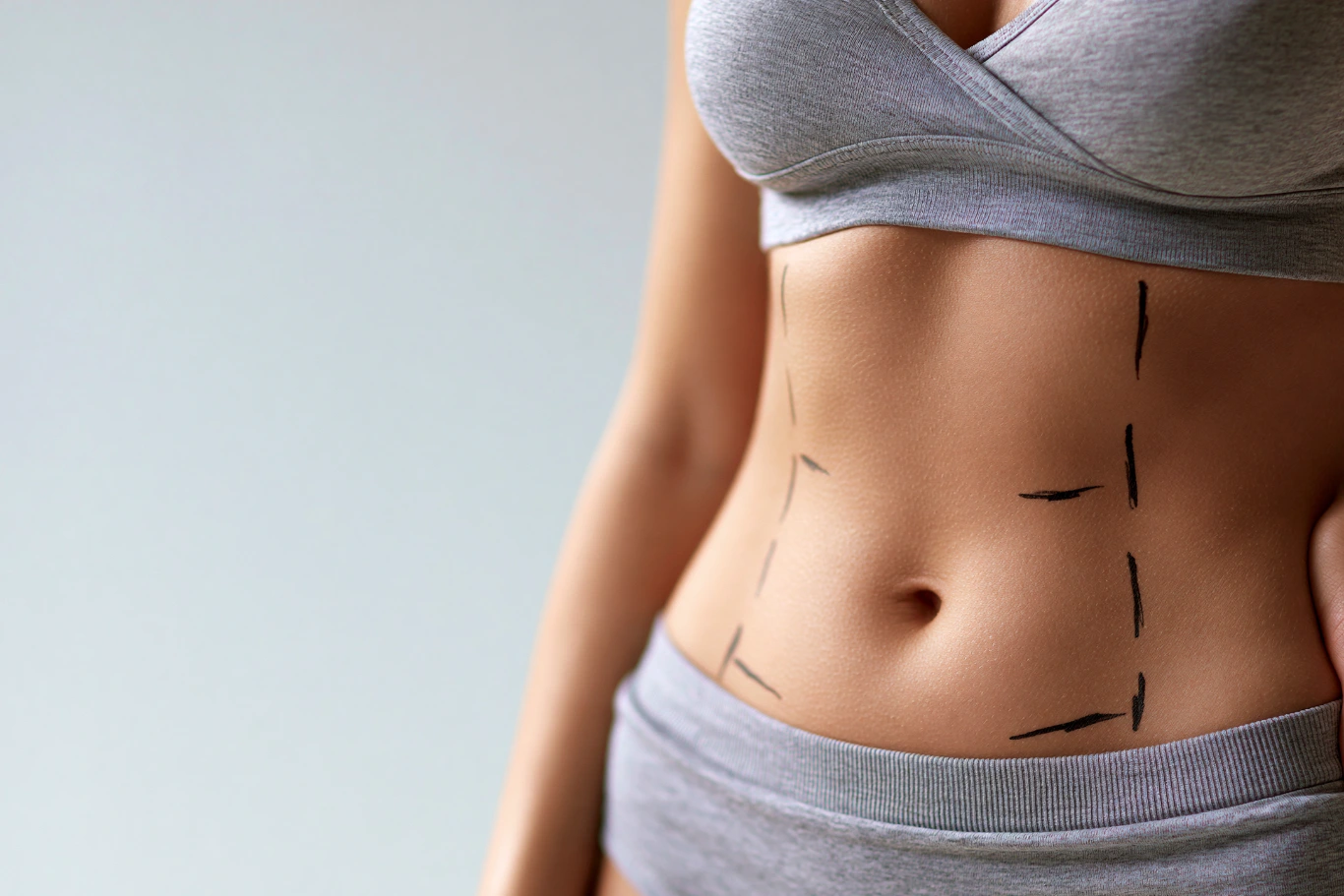 Slim female torso with surgical markings for tummy tuck Woman in gray sportswear with surgical markings on abdomen